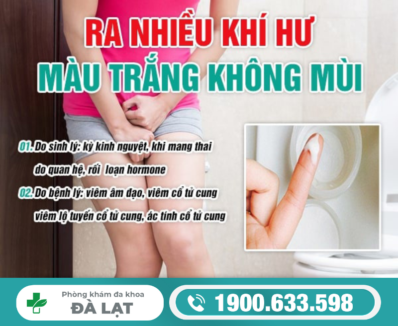 Hình ảnh minh họa